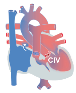 Cardiologie Des Enfants Les Principales Malformations