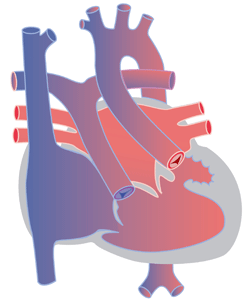 Cardiologie Des Enfants Les Principales Malformations